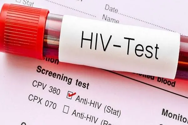 Ghana : baisse des nouvelles infections au VIH et des décès liés au sida en 2025