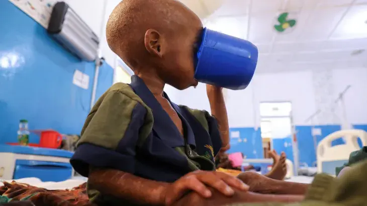 La crise nutritionnelle s'aggrave en Somalie sous l'effet du retrait brutal de l'aide internationale