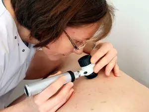 Le vaccin personnalisé contre le mélanome franchit une étape décisive dans la lutte contre les récidives