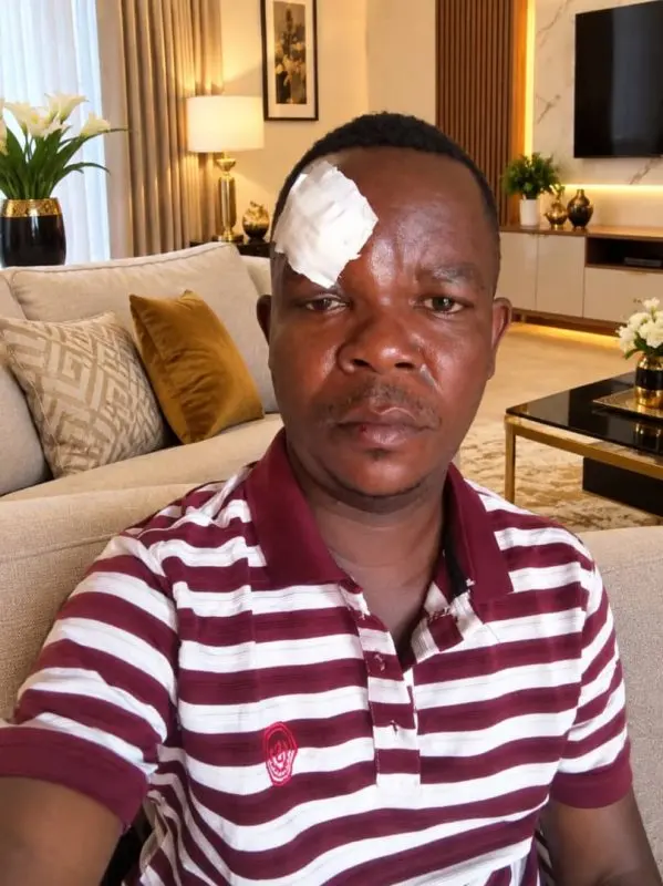 Assaut contre le blogueur burundais Kenny Claude Nduwimana soulève des doutes sur la protection des journalistes et l’action policière