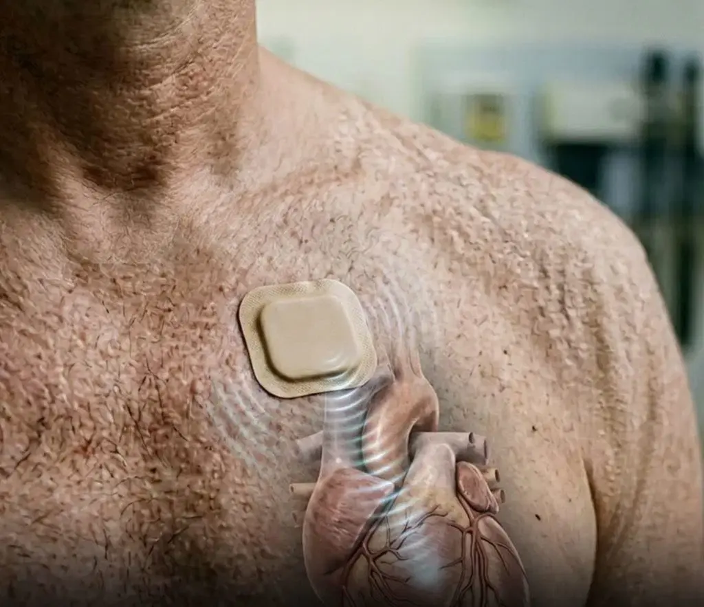 Vers une cardiologie sans chirurgie : le potentiel thérapeutique des stimulateurs cardiaques à ultrasons