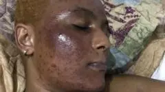 Cosmétiques toxiques en Afrique : les dangers d'un marché informel non régulé