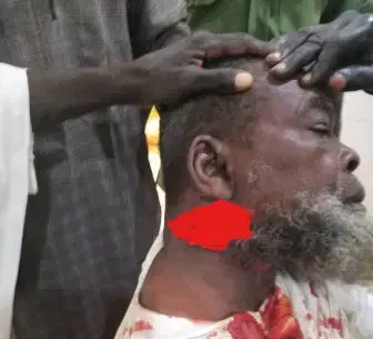 Le cheikh Lukuwa blessé à Sokoto lance un appel au calme pour prévenir toute escalade