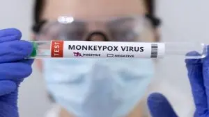 Le Cap-Occidental intensifie son dispositif sanitaire face à la recrudescence des cas de Mpox