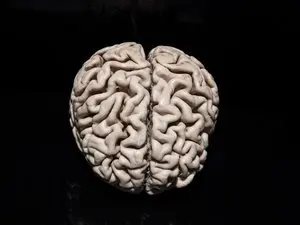 Diagnostic précoce d'Alzheimer : l'innovation française face au blocage des nouveaux traitements